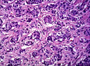 急性阑尾炎是怎么形成的 6087.jpg