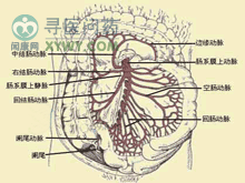 肠系膜上动脉压迫综合征
