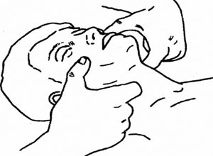 低氧血症,低氧血症的原因,低氧血症怎么办-其他科室-其他综合-症状